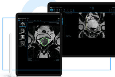 RadioViewer with AI