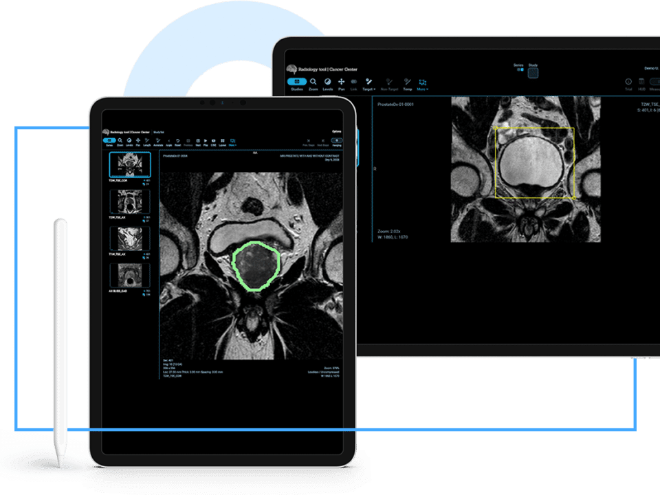 RadioViewer with AI